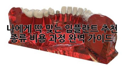 나에게 딱 맞는 임플란트 추천: 종류, 비용, 과정 완벽 가이드